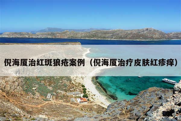 倪海厦治红斑狼疮案例（倪海厦治疗皮肤红疹痒）