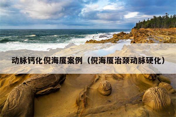 动脉钙化倪海厦案例（倪海厦治颈动脉硬化）